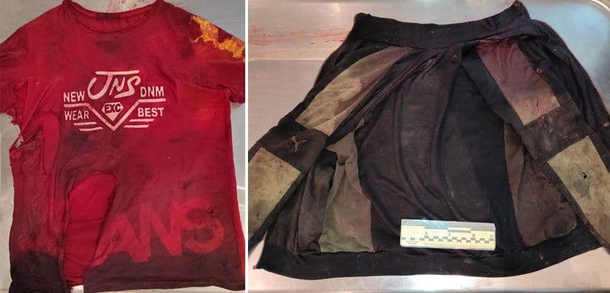 У Миргородському районі біля траси знайшли тіло невідомого чоловіка