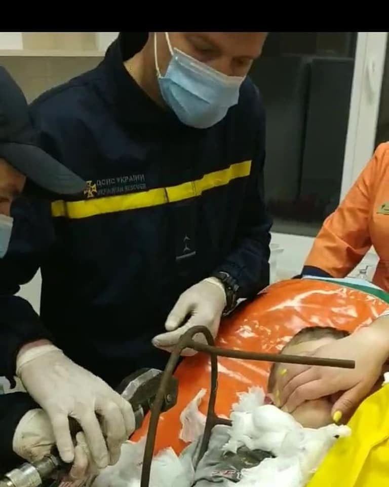 У Полтаві рятувальники звільнили дитину, що наштрикнулась шиєю на металевий штир