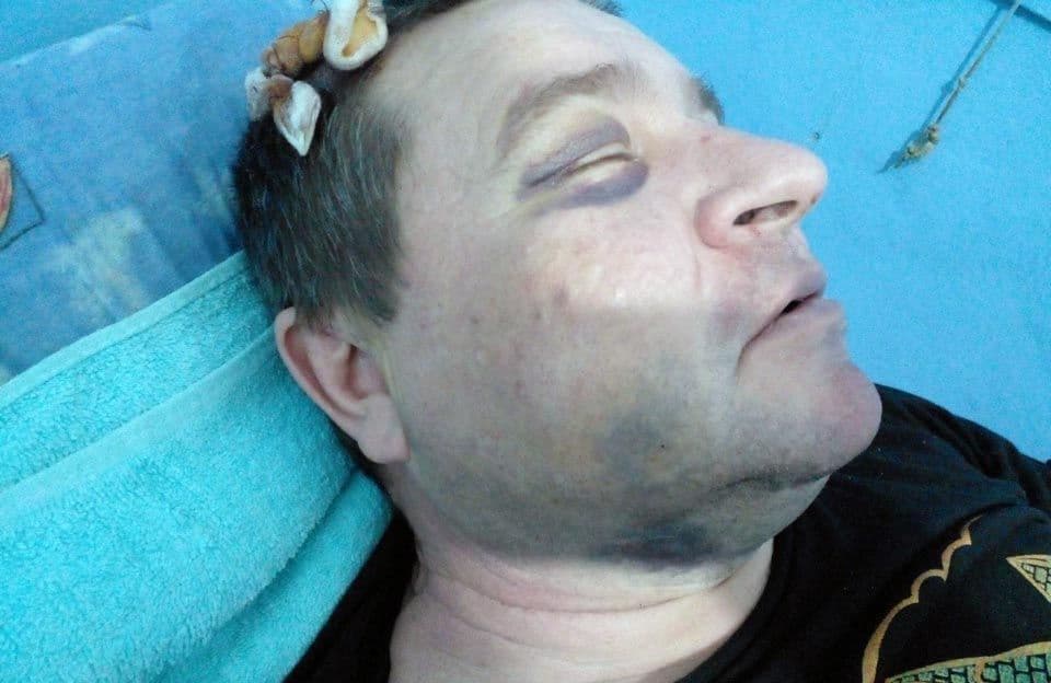 Колишньому військкому з Диканьки оголосили підозру за побиття старшого лейтенанта
