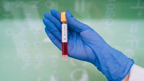 Ще 82 мешканця області заразилося коронавірусом