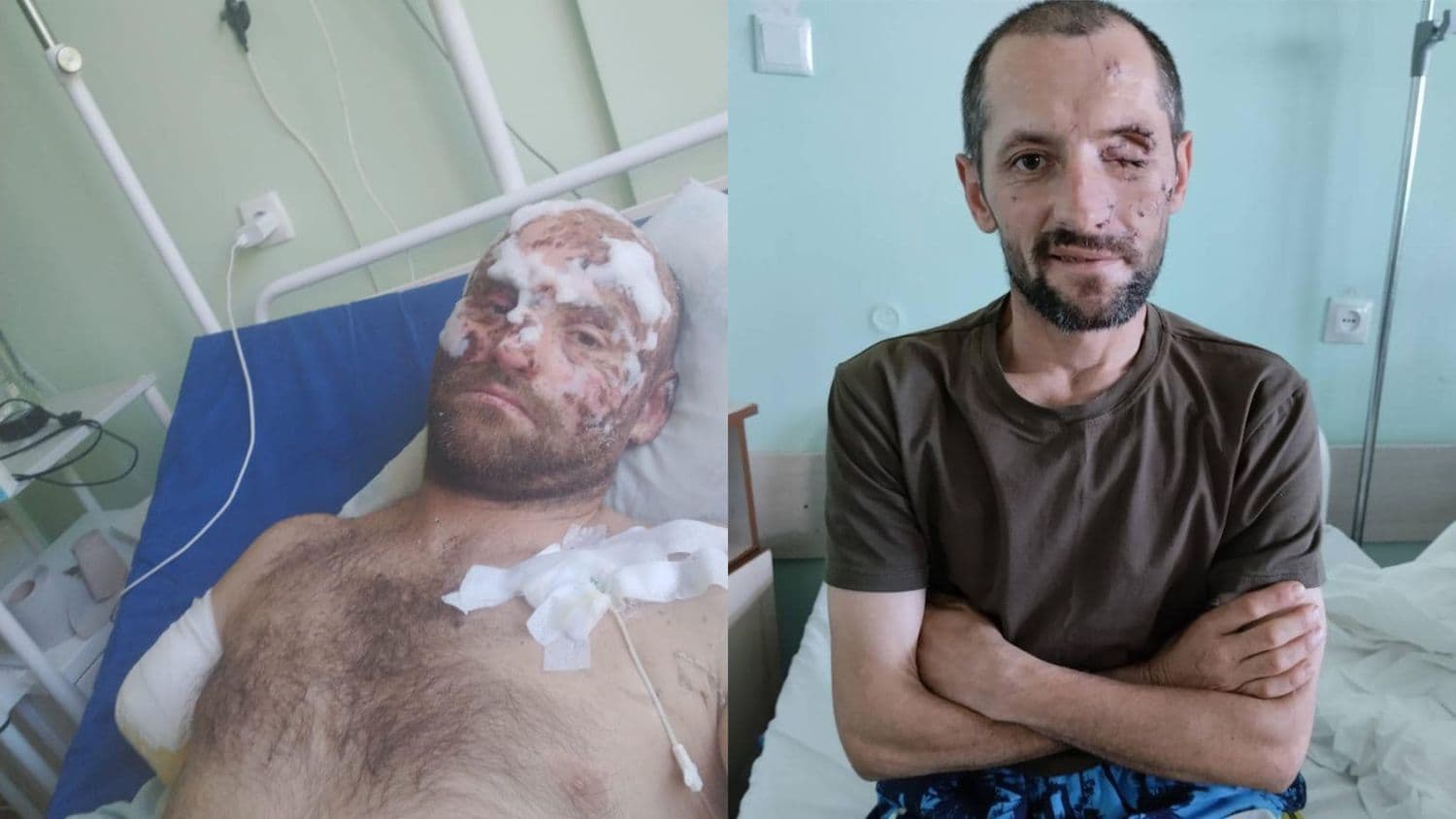Полтавські військові отримали тяжкі поранення і потребують коштів на лікування