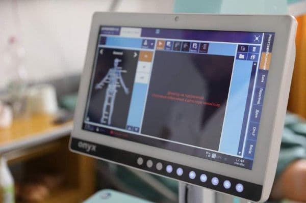 Лікарня на Полтавщині отримала цифровий рентгенапарат