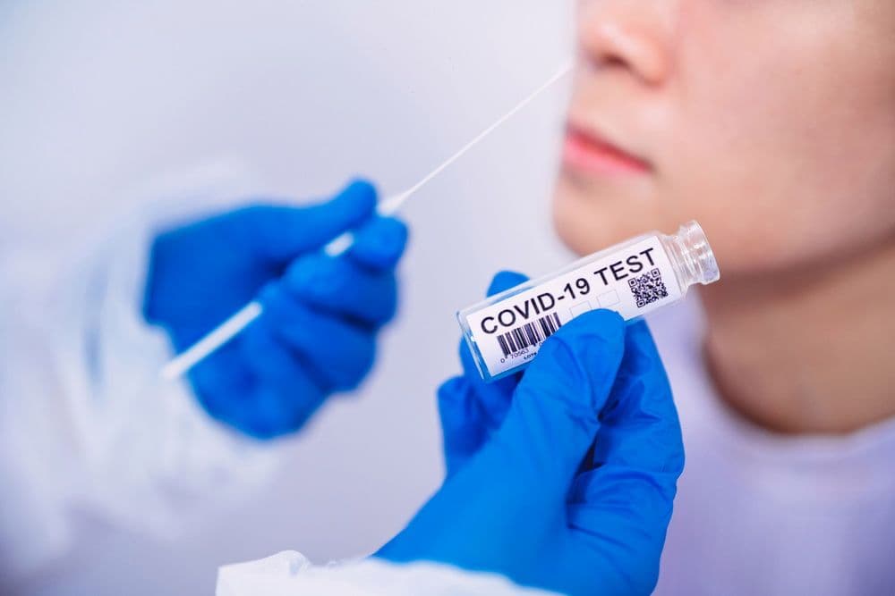 Туристичні агентства Полтави підробляли тести на COVID-19
