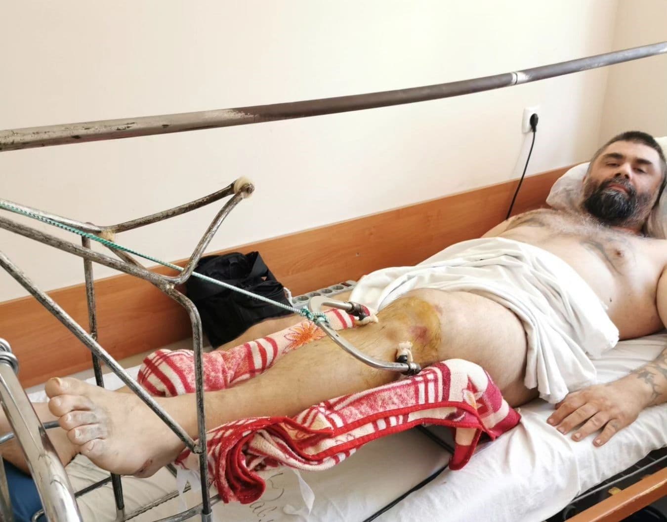 Полтавська родина, яка постраждала від вибуху газу в будинку, потребує допомоги