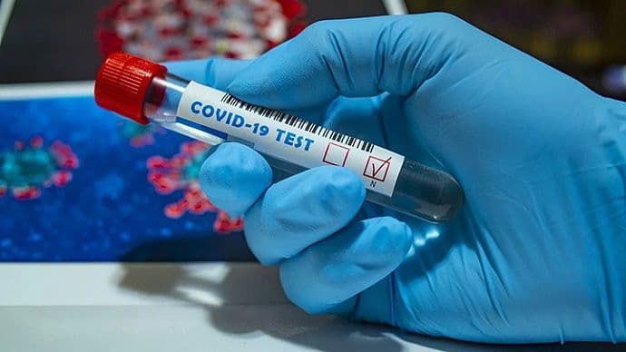На Полтавщині підтвердили 2048 нових випадків захворювання на COVID-19